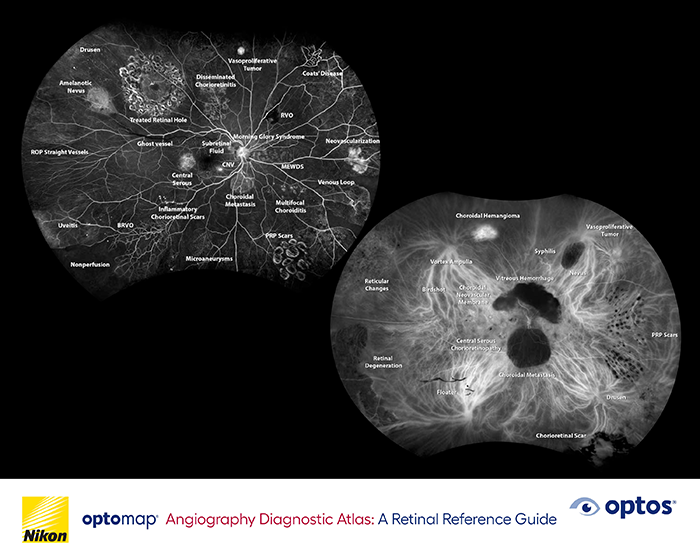 Diagnostic Atlas &ndash; optomap af