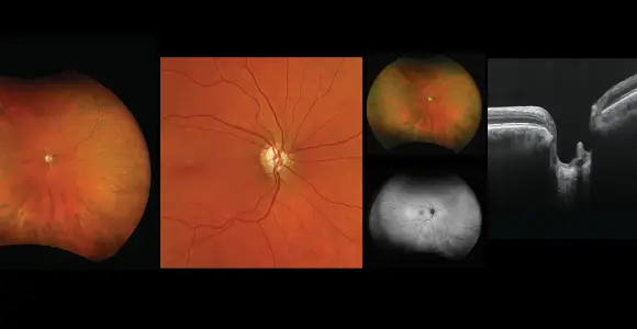 Clinical paper thumbnail image