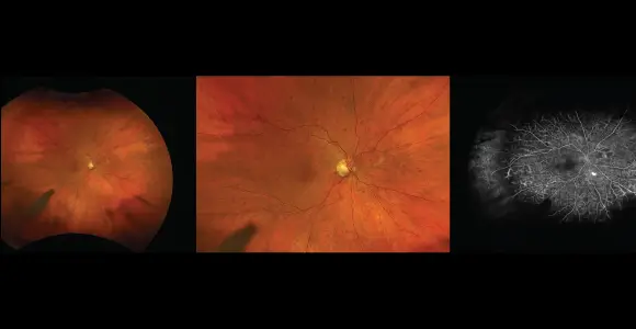 clical paper thumbnail image