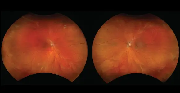 clical paper thumbnail image