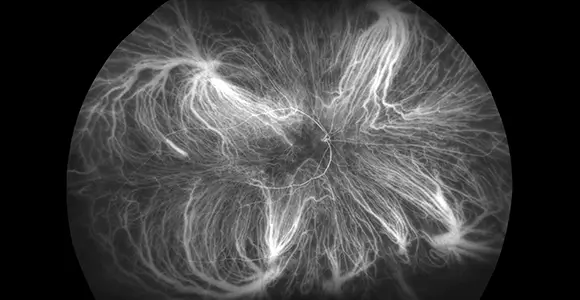 clical paper thumbnail image