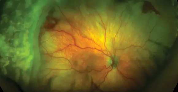 clical paper thumbnail image