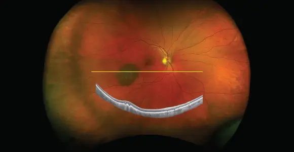 clical paper thumbnail image