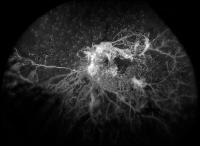 retinal scan 