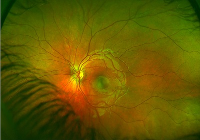 retinal scan 