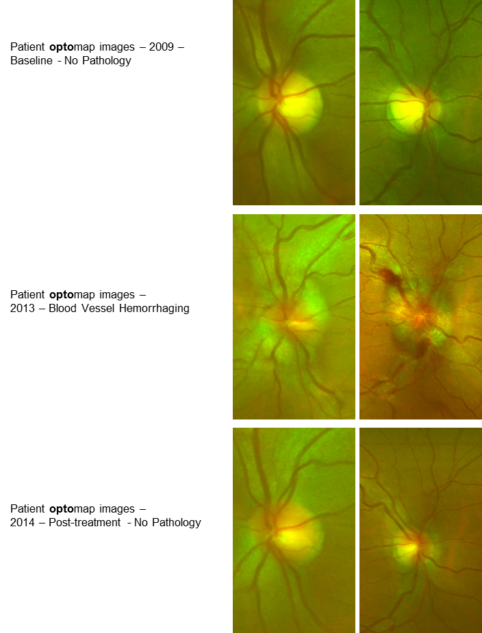 comparison of optomap images