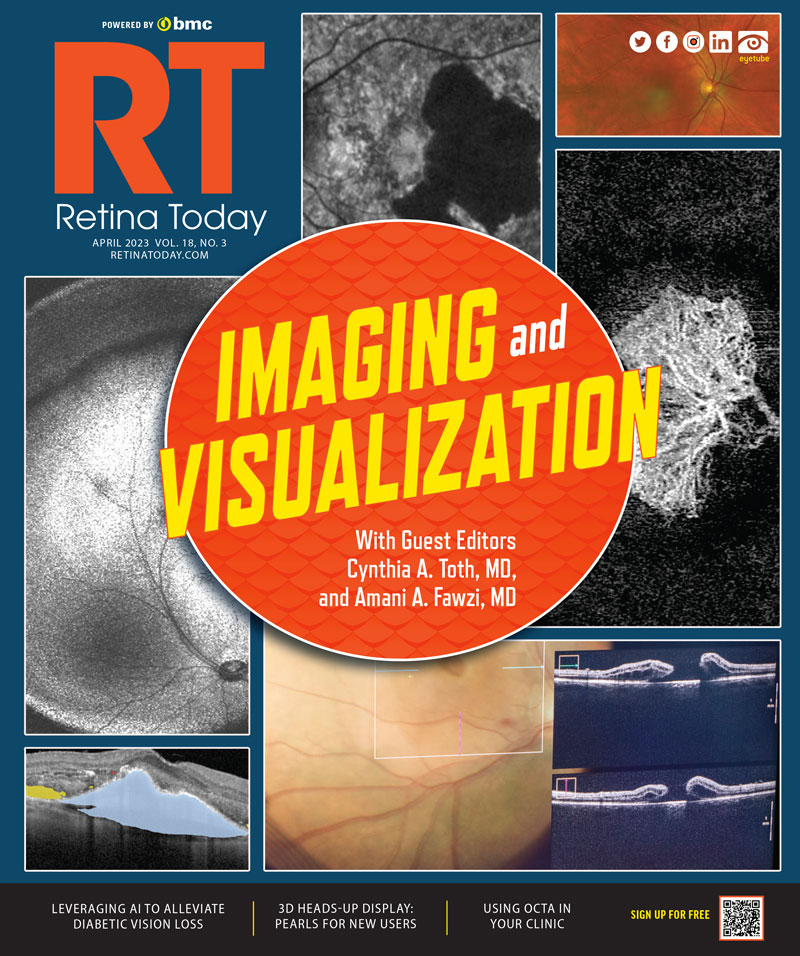 Retina Today April 2023, Vol 18, No 3 image