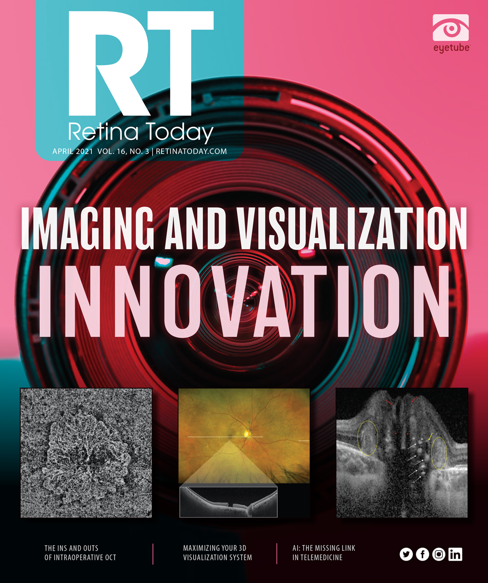 Retina Today April 2021, Vol. 16, No. 3 image