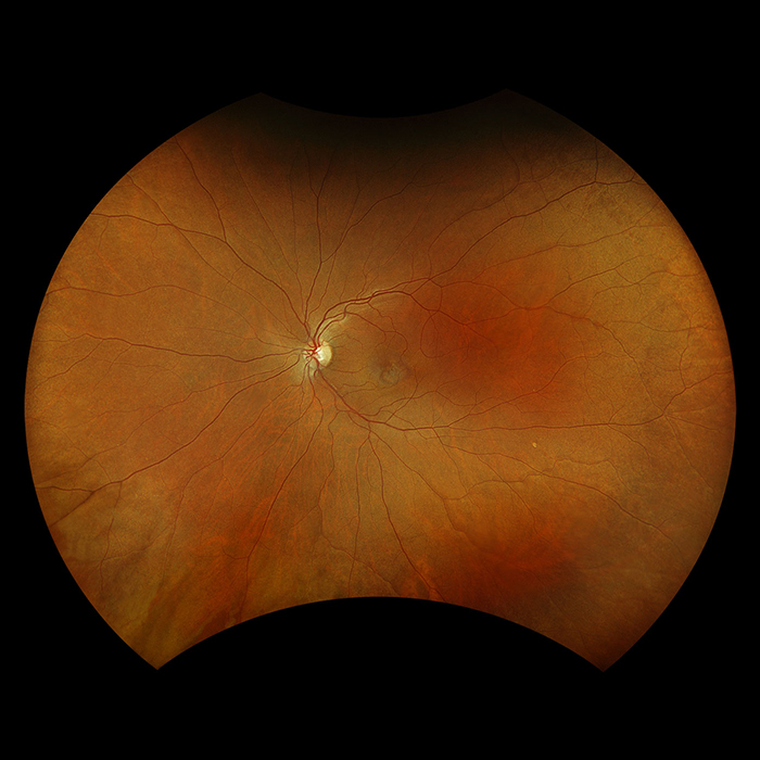 Modality optomap-color-rgb.jpg