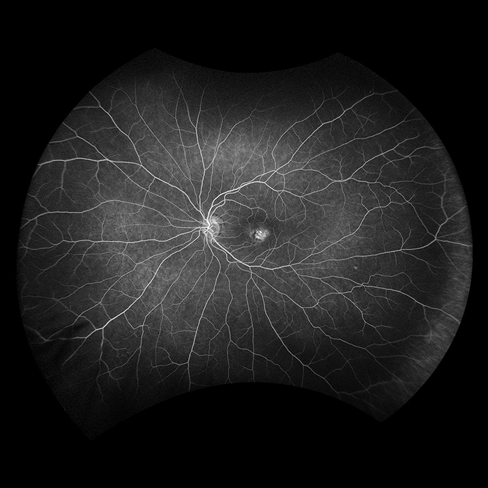 optomap fa