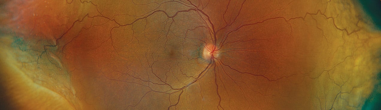 optomap icg image from California