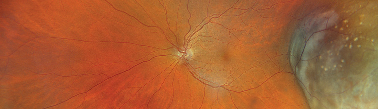 Color rgb with Oncology