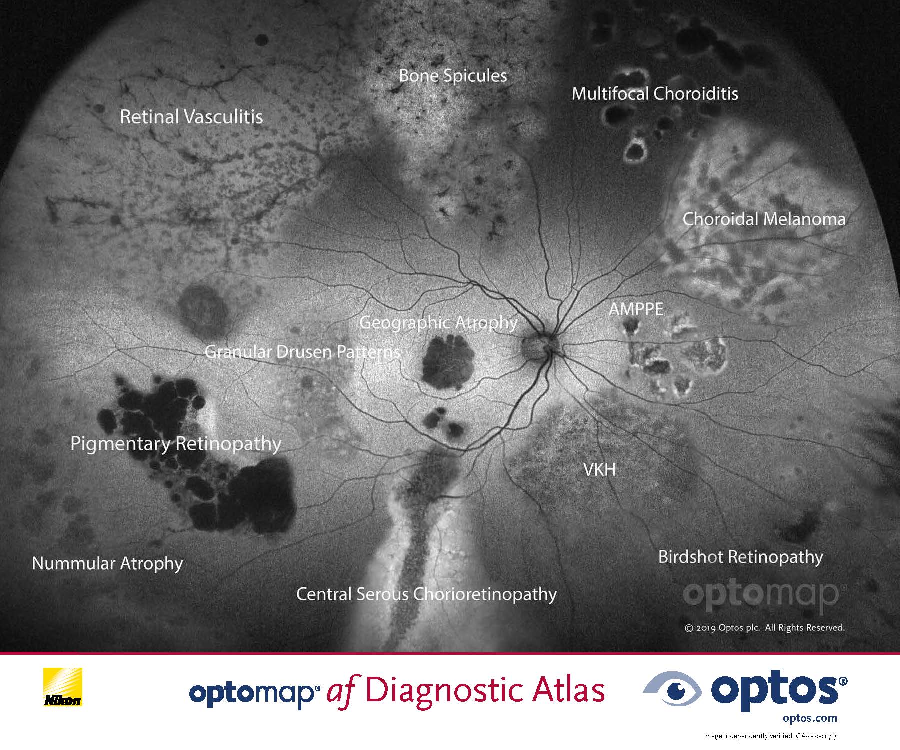 optomap AF Diagnostic Atlas