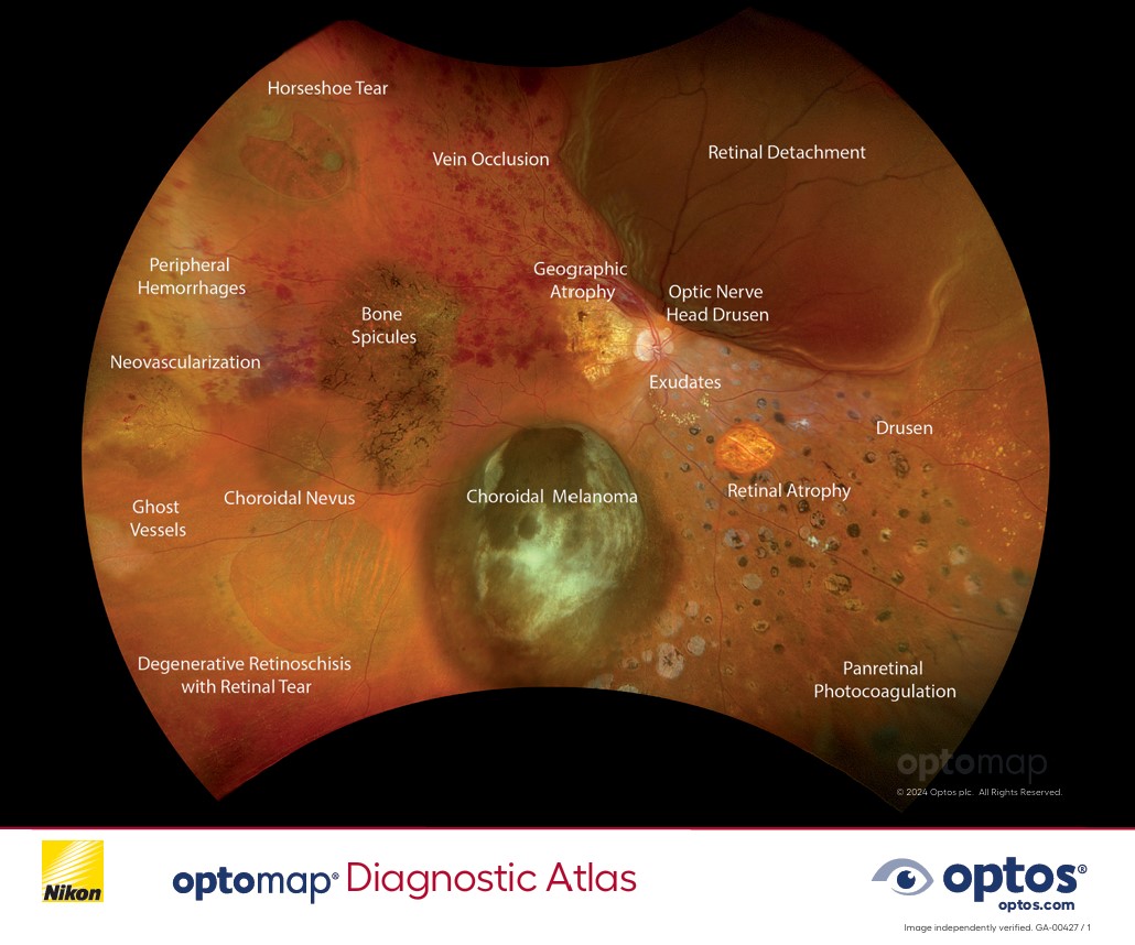 <p><strong>Diagnostic Atlas - opto</strong>map <em><span class="optos-red">color rgb</span></em></p> image