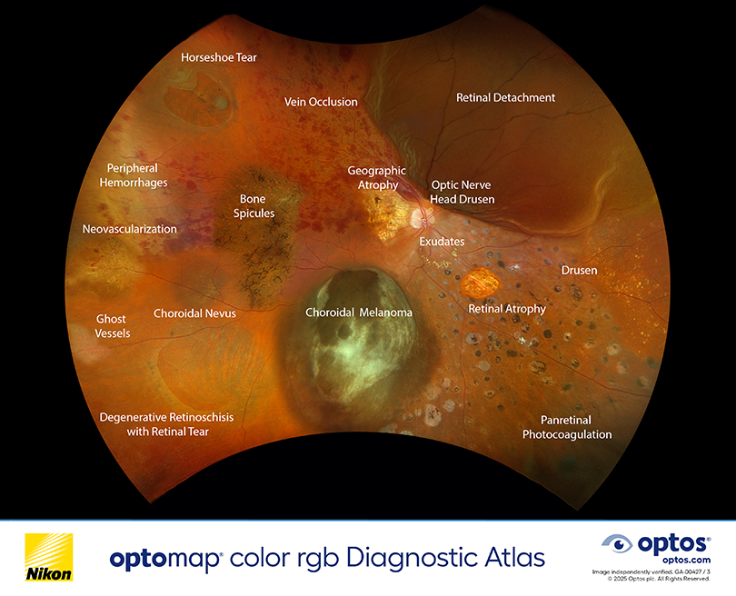 optomap color rgb Diagnostic Atlas