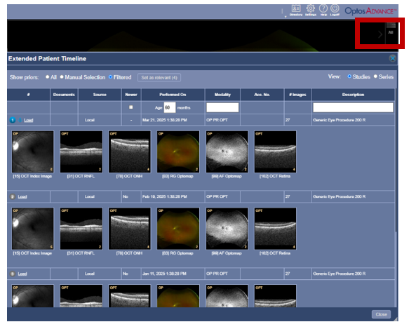 OA Comparing Prior Images Changing Prior Image