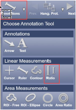 OA Cup To Disc Ratio Annotations Ratio