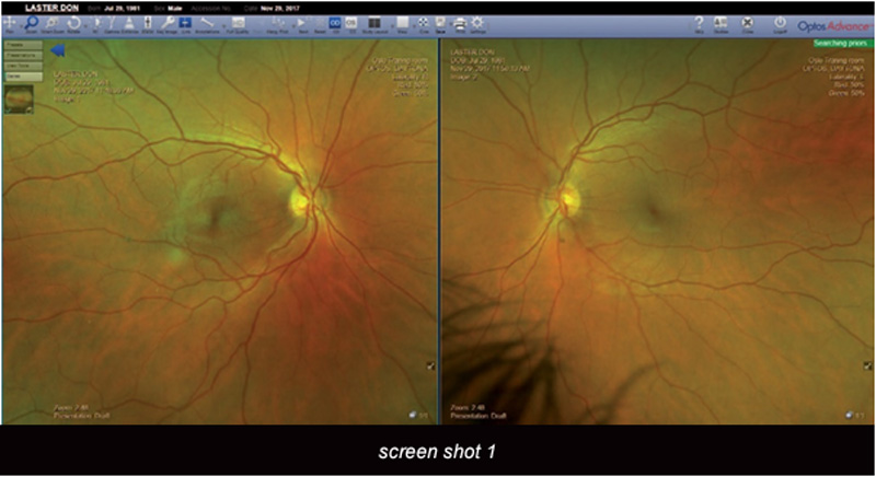 oa image review