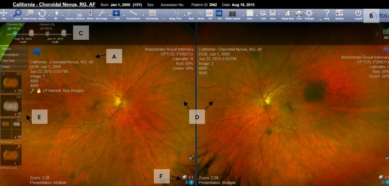 OptosAdvance Image Review Instructions