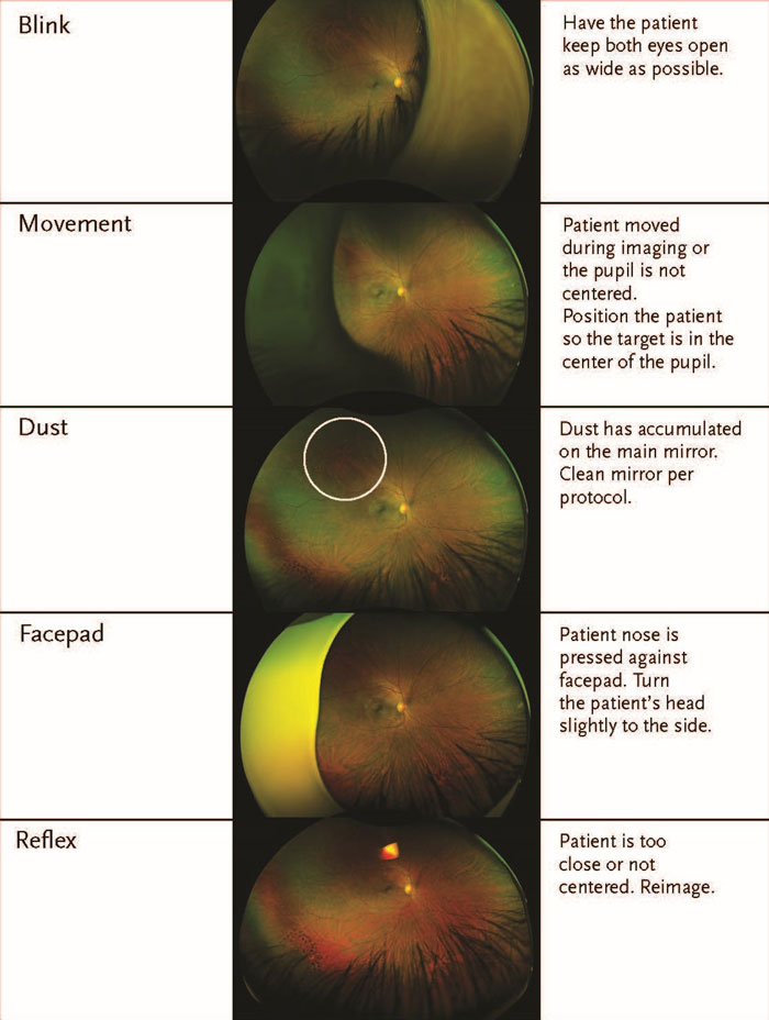 troubleshooting image quality page 2