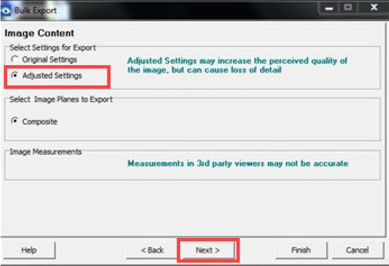 Step 10 Vantage Bulk Export to OptosAdvance