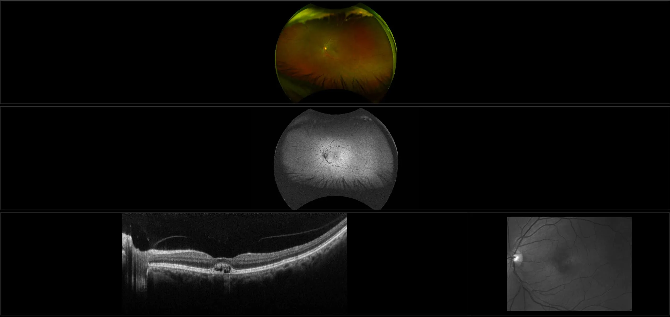 MonacoPro - AMD with CNV, RG, AF, OCT
