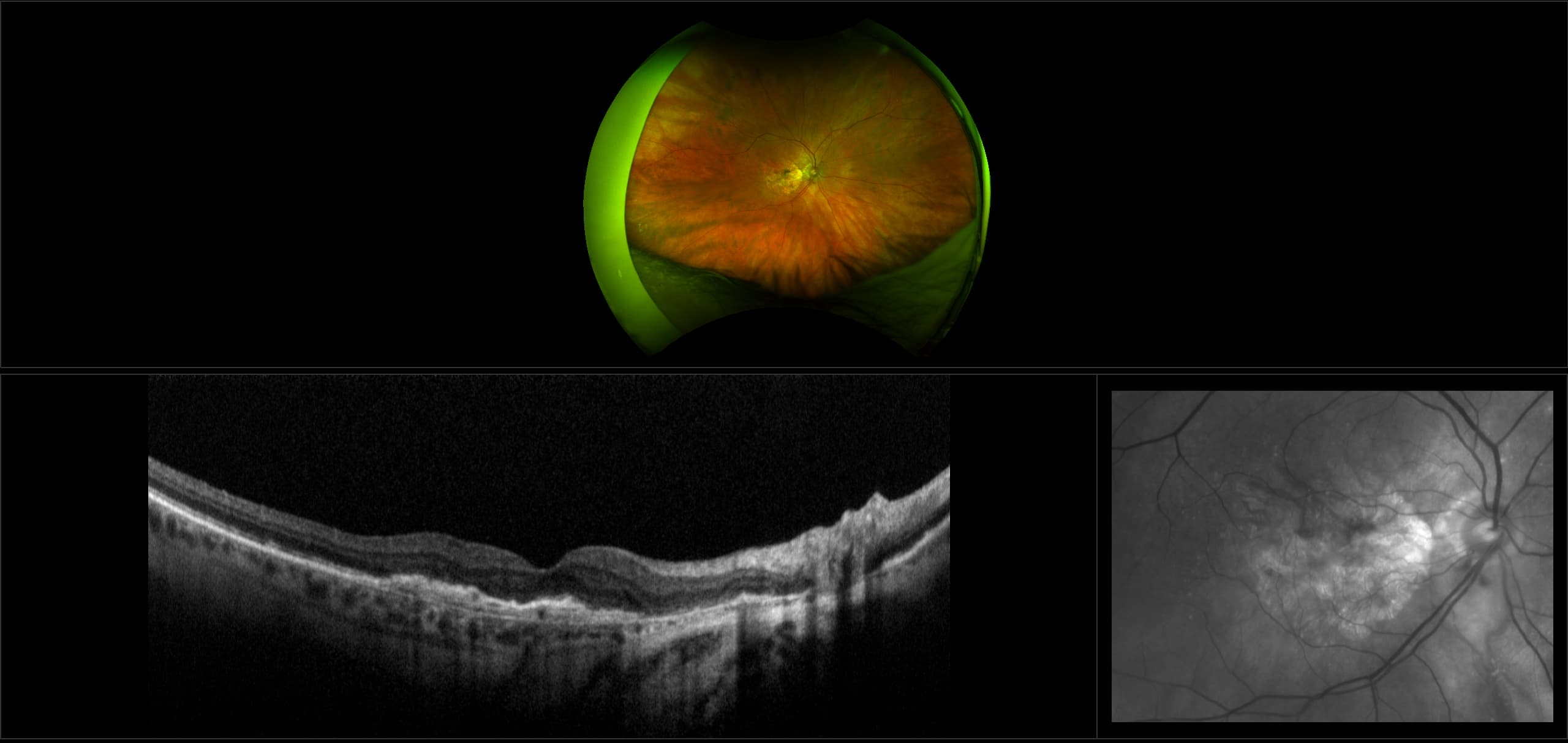 Monaco - AMD with CNV, RG, OCT